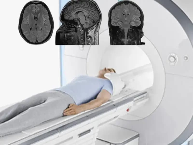 Uyku Beyni Yaşlandırıyor mu? Bilim İnsanları Bu Soruyu Araştırıyor