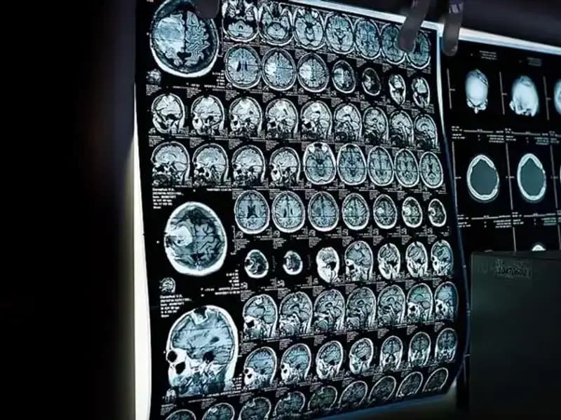 İstanbul'da 81 Bini Aşkın Kişiye Ücretsiz Kanser Taraması Fırsatı!