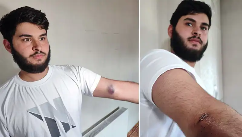 Bahçeye Kaçan Top, Mahallede İlginç Olaylara Neden Oldu